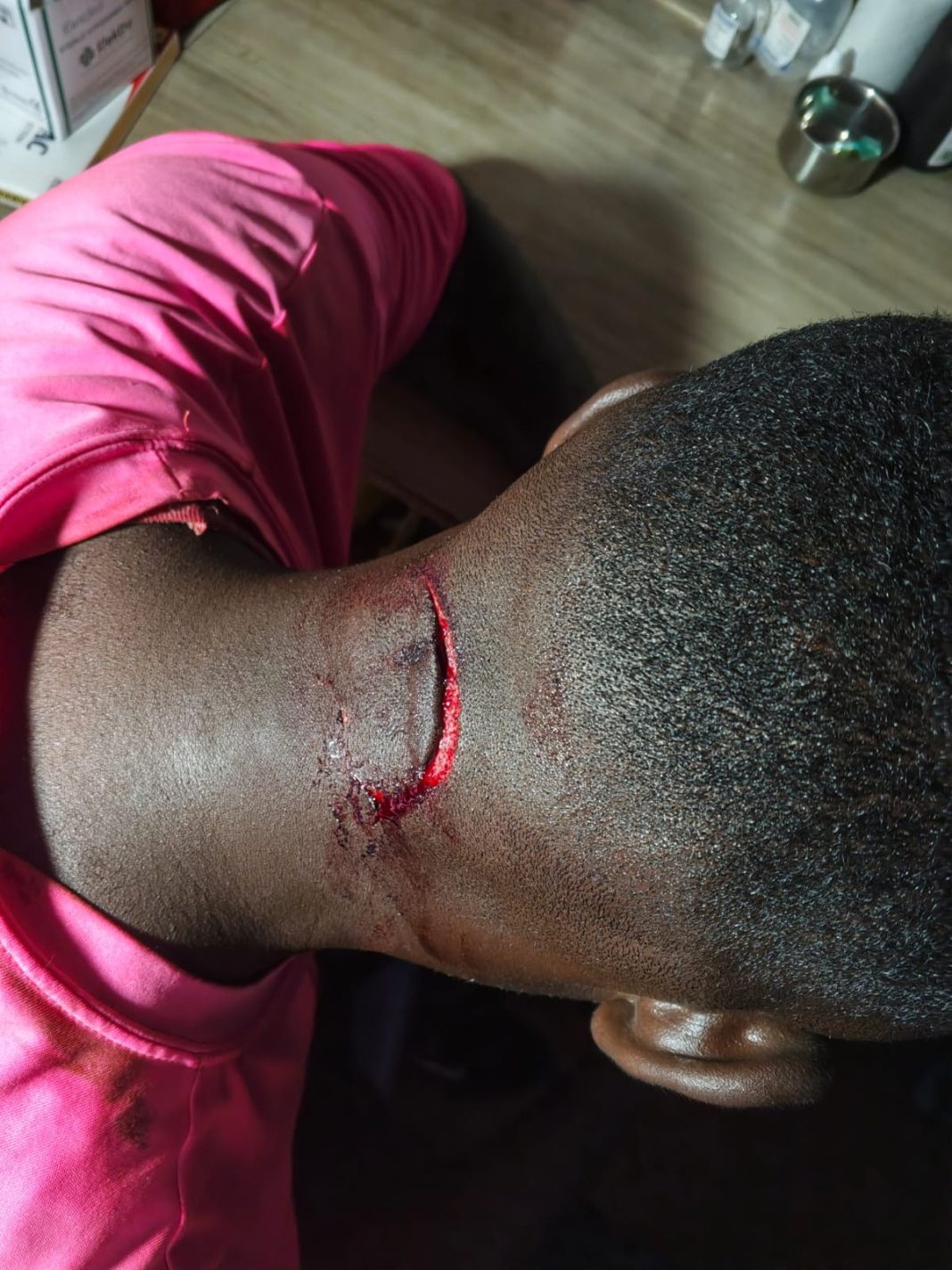 Youth allied to political opponent beaten at Governor Wanga, Gogo’s function in Kochia, sustains panga cut Youth allied to political opponent beaten at Governor Wanga, Gogo’s function in Kochia, sustains panga cut